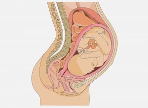 Рис. 1. Во время беременности увеличивается внутрибрюшное давление, что может вызвать геморрой.