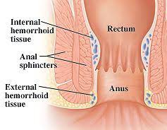 Рис. 1. Геморроидальное сплетение вен прямой кишки есть у всех и помогает удерживать содержимое кишечника.